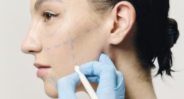 7 preguntas que debes hacerte antes de someterte a un tratamiento estético