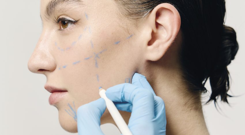 7 preguntas que debes hacerte antes de someterte a un tratamiento estético