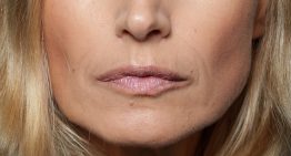 Arkaitz Felices, cosmetólogo: «Si dejas los parches de ojos más de 15 minutos, la piel empieza a devolver los activos al parche y a la inversa, y así sucesivamente»