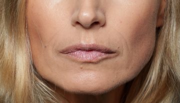 Arkaitz Felices, cosmetólogo: «Si dejas los parches de ojos más de 15 minutos, la piel empieza a devolver los activos al parche y a la inversa, y así sucesivamente»