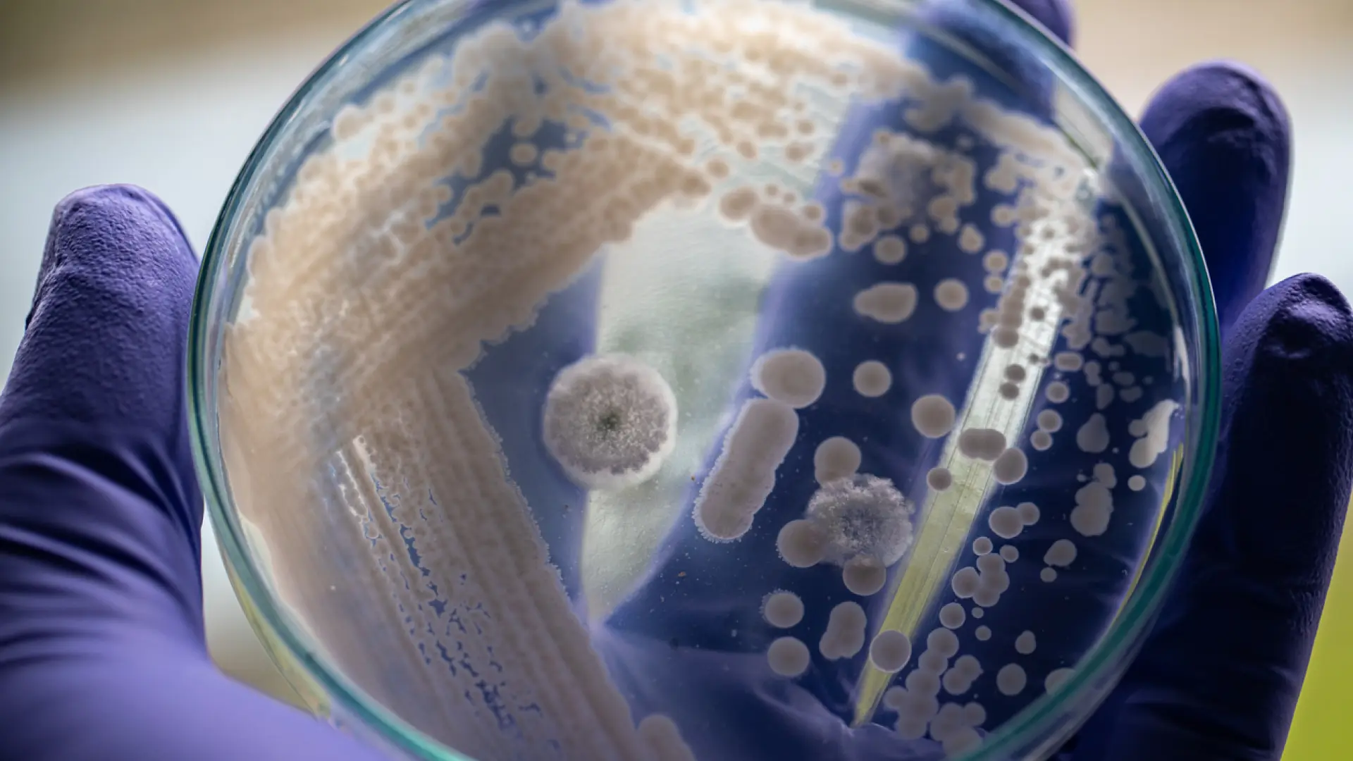 'C. auris', el hongo presente en España que causa infecciones en personas vulnerables: «Sobrevive en hospitales y equipo médico»