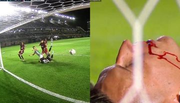 Video: el impactante corte en el rostro del arquero Losada en el gol de Banfield