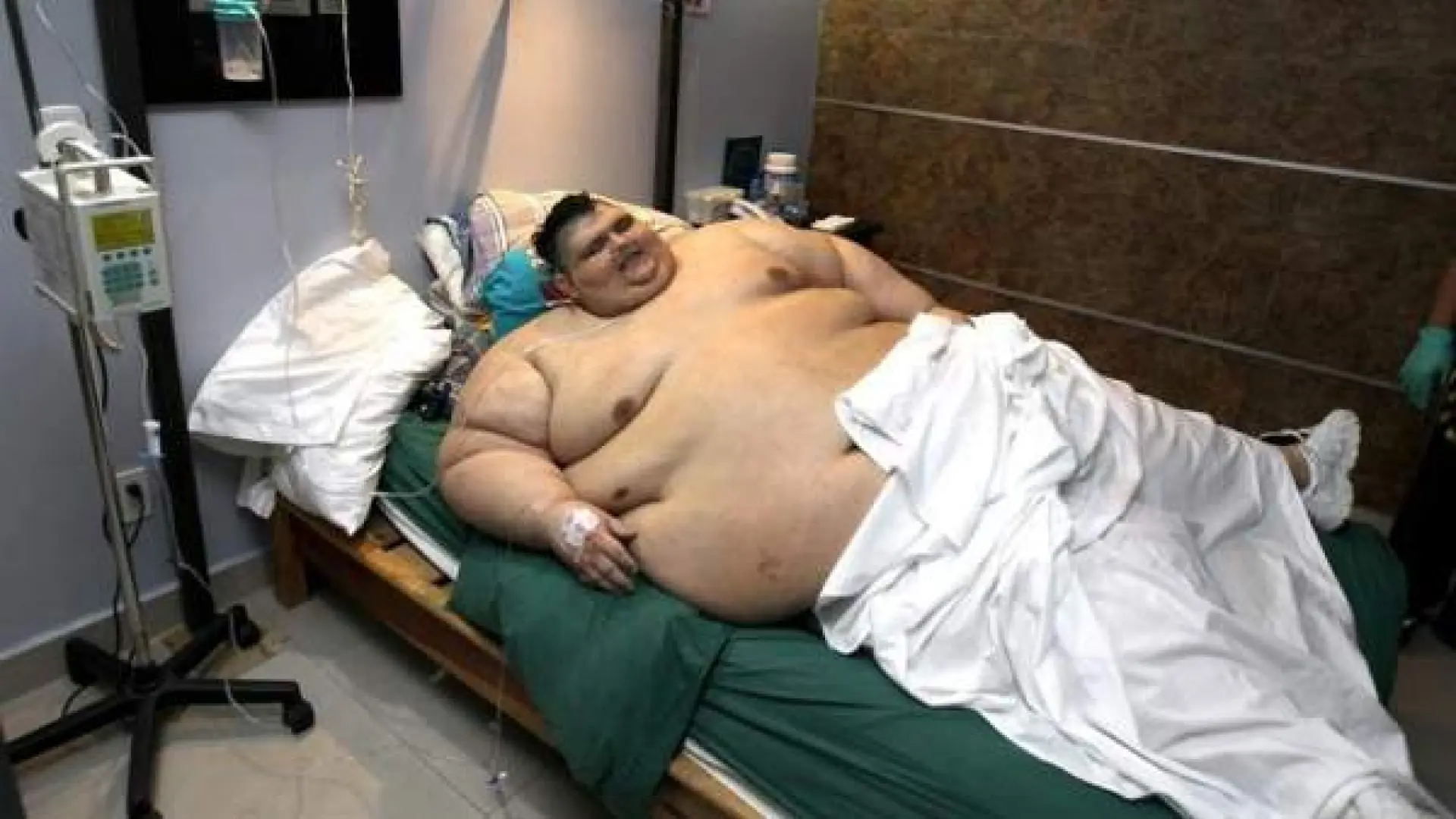 Muere Juan Pedro Franco, conocido por haber sido el hombre más obeso del mundo