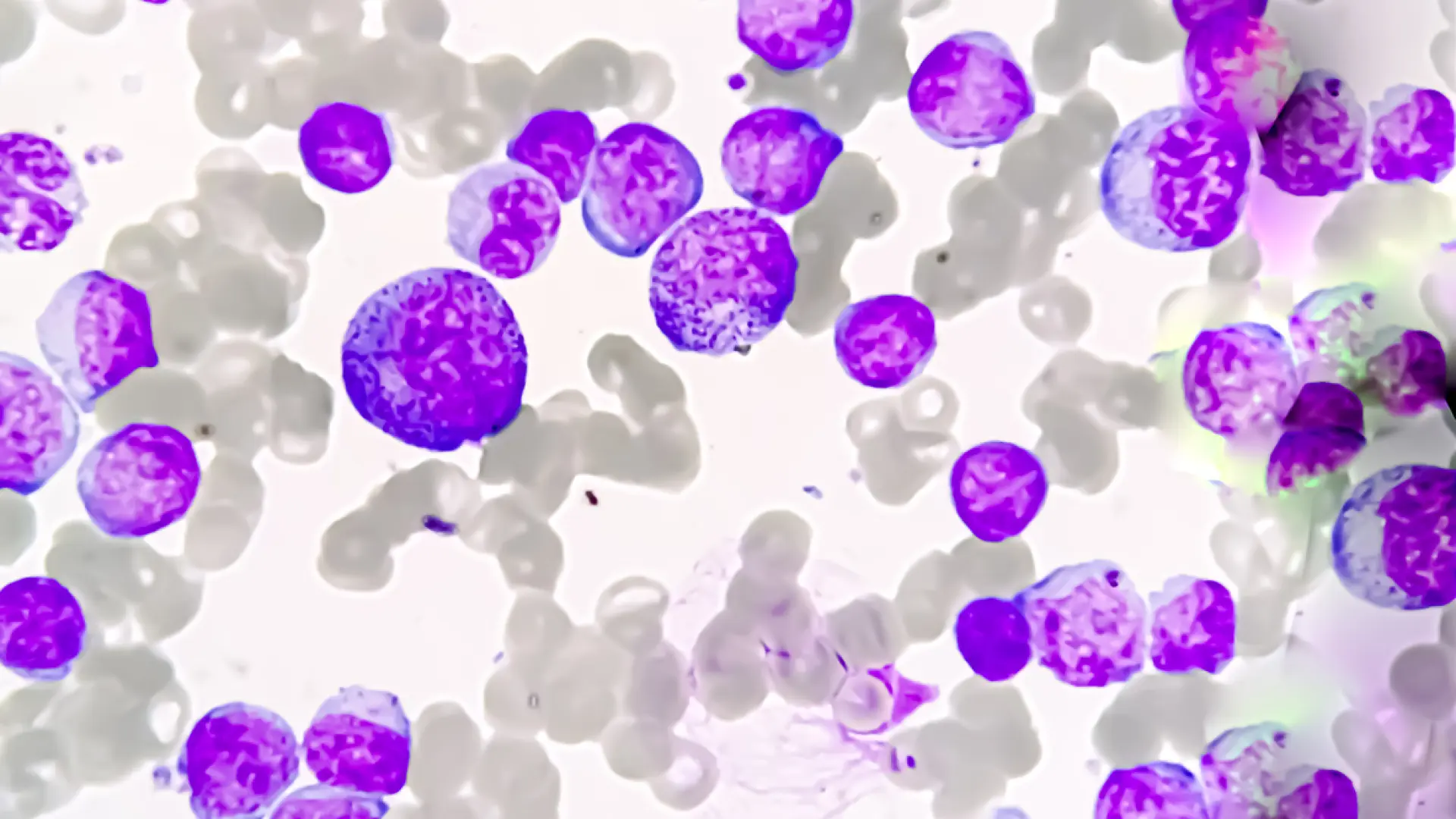 Redefinen el papel, a veces caótico, de los neutrófilos, primera línea del sistema inmune