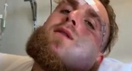 Jake Paul mostró cómo tiene la cara a cinco días del nocaut de Anthony Joshua que le destruyó la mandíbula