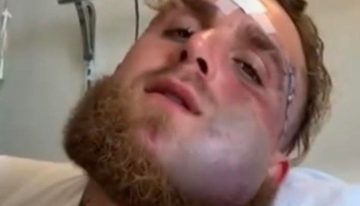 Jake Paul mostró cómo tiene la cara a cinco días del nocaut de Anthony Joshua que le destruyó la mandíbula