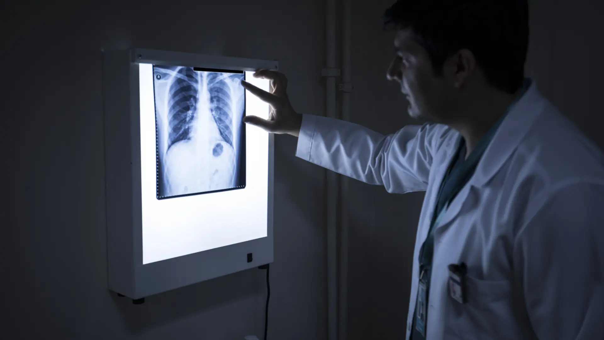 «Como si me comiera desde dentro»: la enfermedad que ataca a los huesos y provoca amputaciones en el norte de Kenia