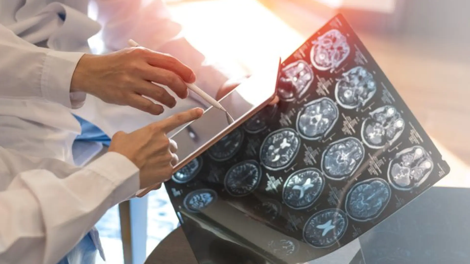 Esclerosis múltiple: síntomas, cómo detectarla a tiempo y la posible vacuna