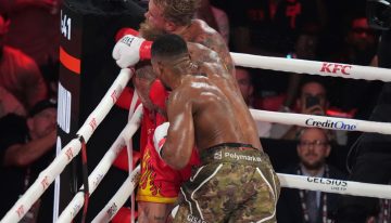 La radiografía que muestra la «doble mandíbula rota» de Jake Paul tras el brutal nocaut de Anthony Joshua