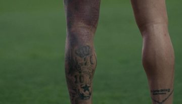 La impactante imagen del moretón de Rodrigo De Paul: ¿llega al amistoso de la Selección en la Bombonera?