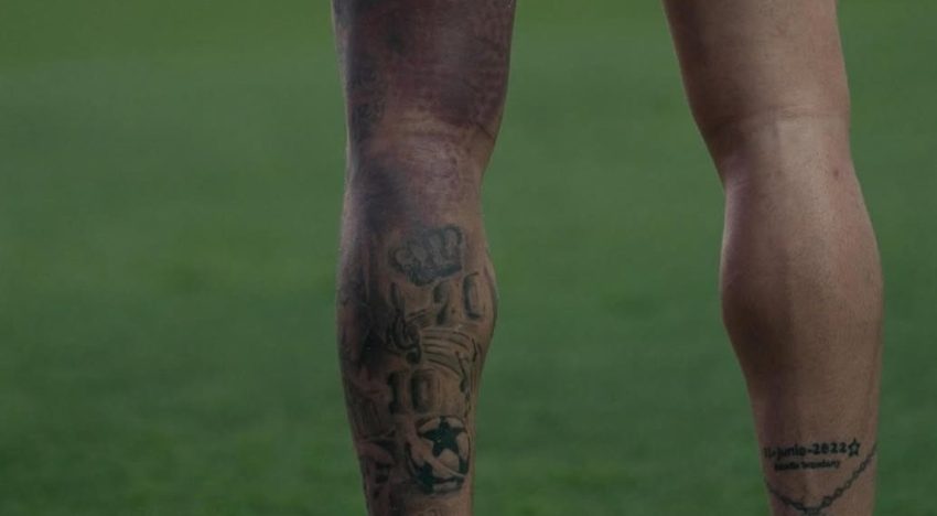 La impactante imagen del moretón de Rodrigo De Paul: ¿llega al amistoso de la Selección en la Bombonera?