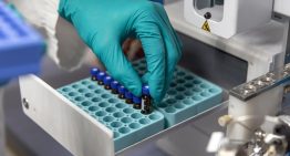 Crisis silenciosa: laboratorios públicos en Venezuela operan con 80% de déficit de insumos