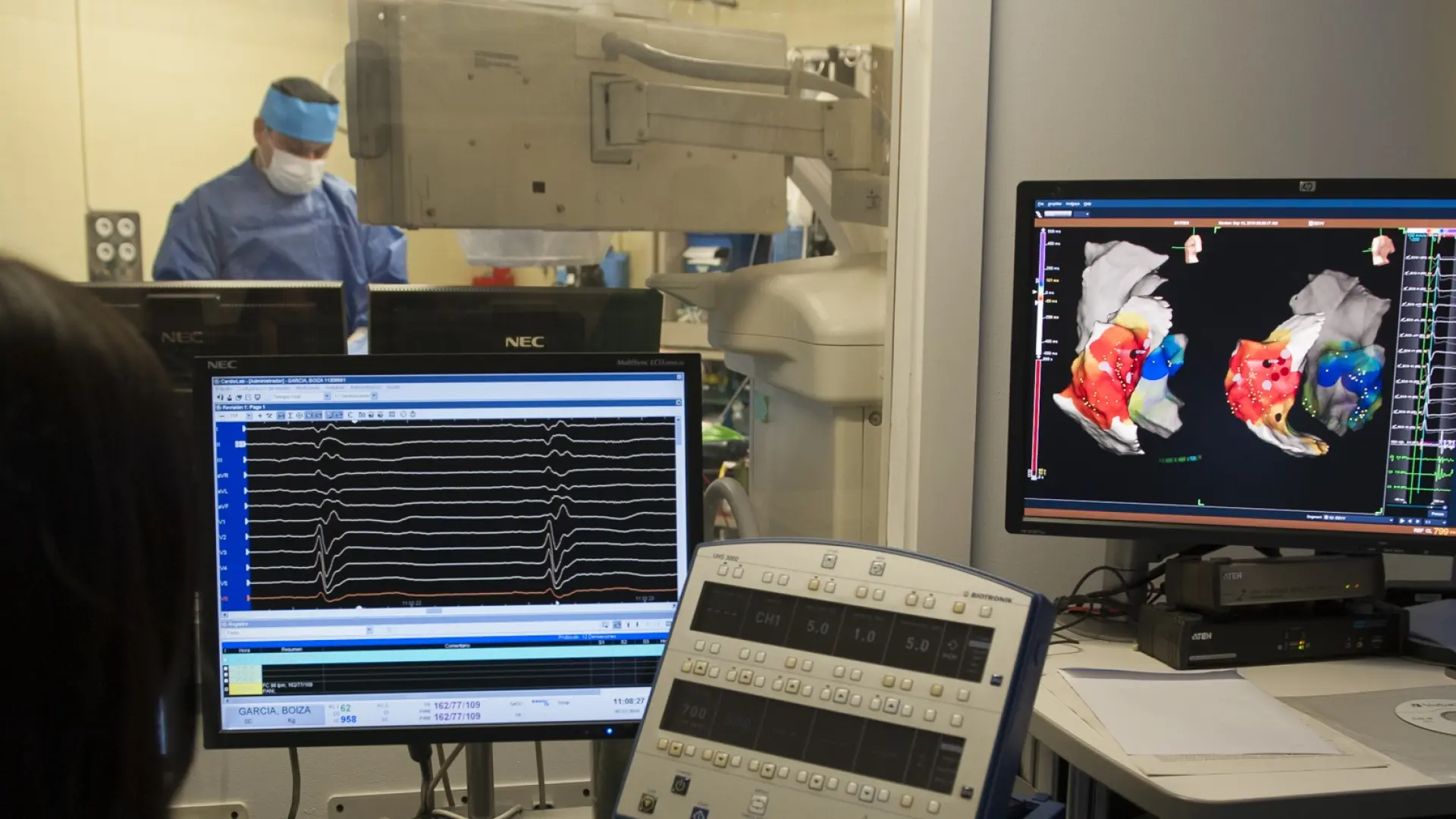 El hospital de Bellvitge reduce a una hora el tratamiento de arritmias más frecuentes