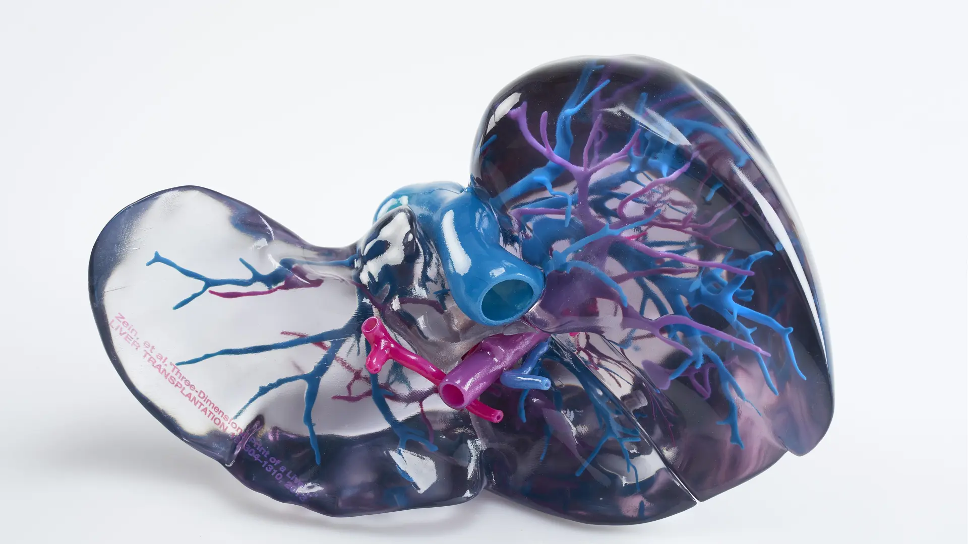 Identifican un mecanismo clave para frenar la progresión del cáncer de hígado