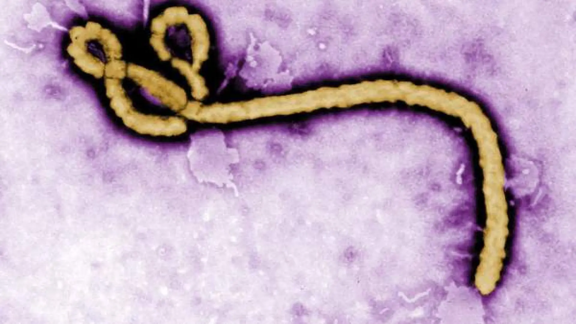 La OMS declara la emergencia internacional por un brote de ébola en República Democrática del Congo y Uganda