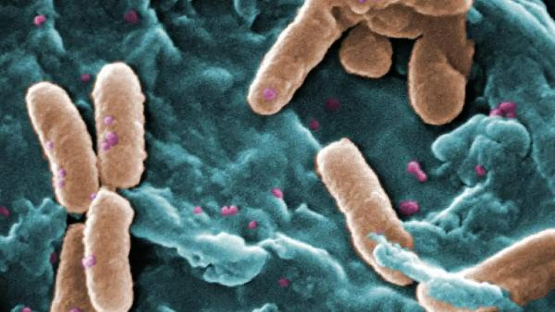Hallan el punto débil de una de las 15 bacterias más peligrosas para la salud humana