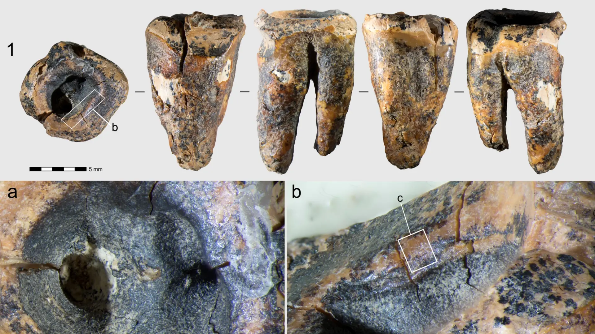 Los neandertales trataban las caries usando herramientas de piedra hace 60.000 años