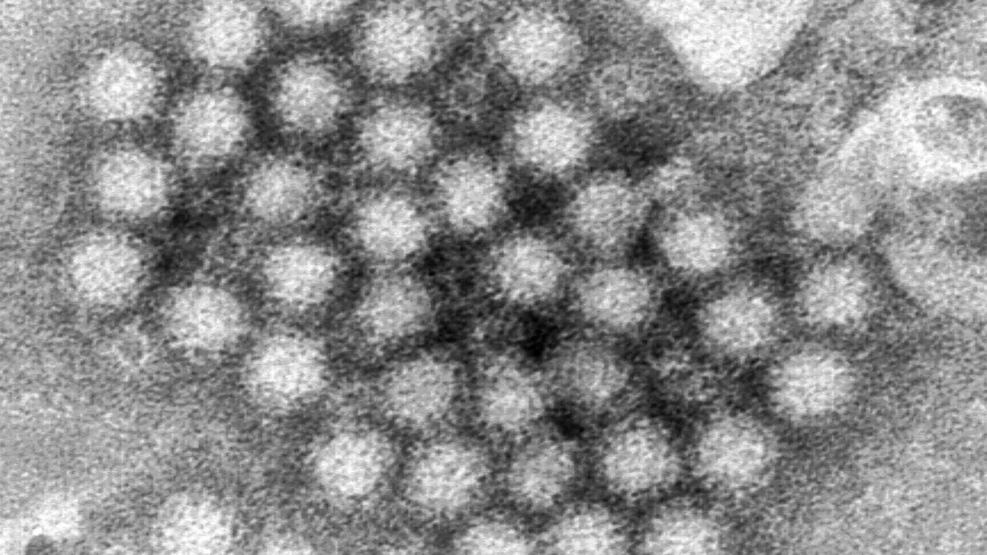 Altamente contagioso, transmisible y resistente: el trinomio que hace que el norovirus sea la pesadilla de los cruceros
