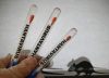 ¿Existe riesgo por hantavirus en Venezuela?