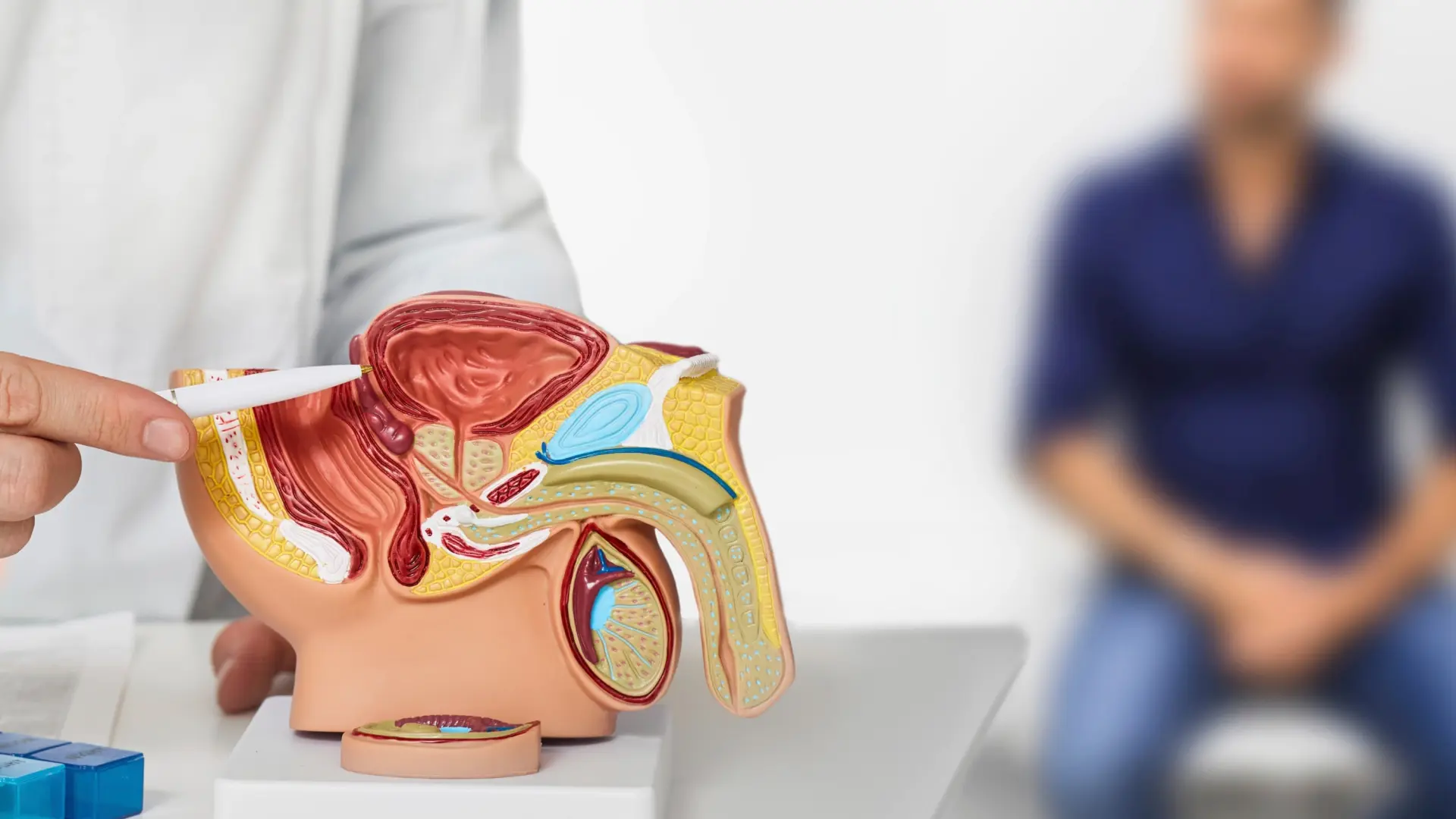 El enemigo invisible: el cáncer de próstata puede no dar síntomas y esperar a notarlos aumenta el riesgo de progresión
