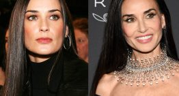 Así eran antes y así son ahora las famosas después de los retoques estéticos