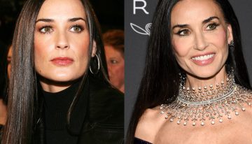 Así eran antes y así son ahora las famosas después de los retoques estéticos