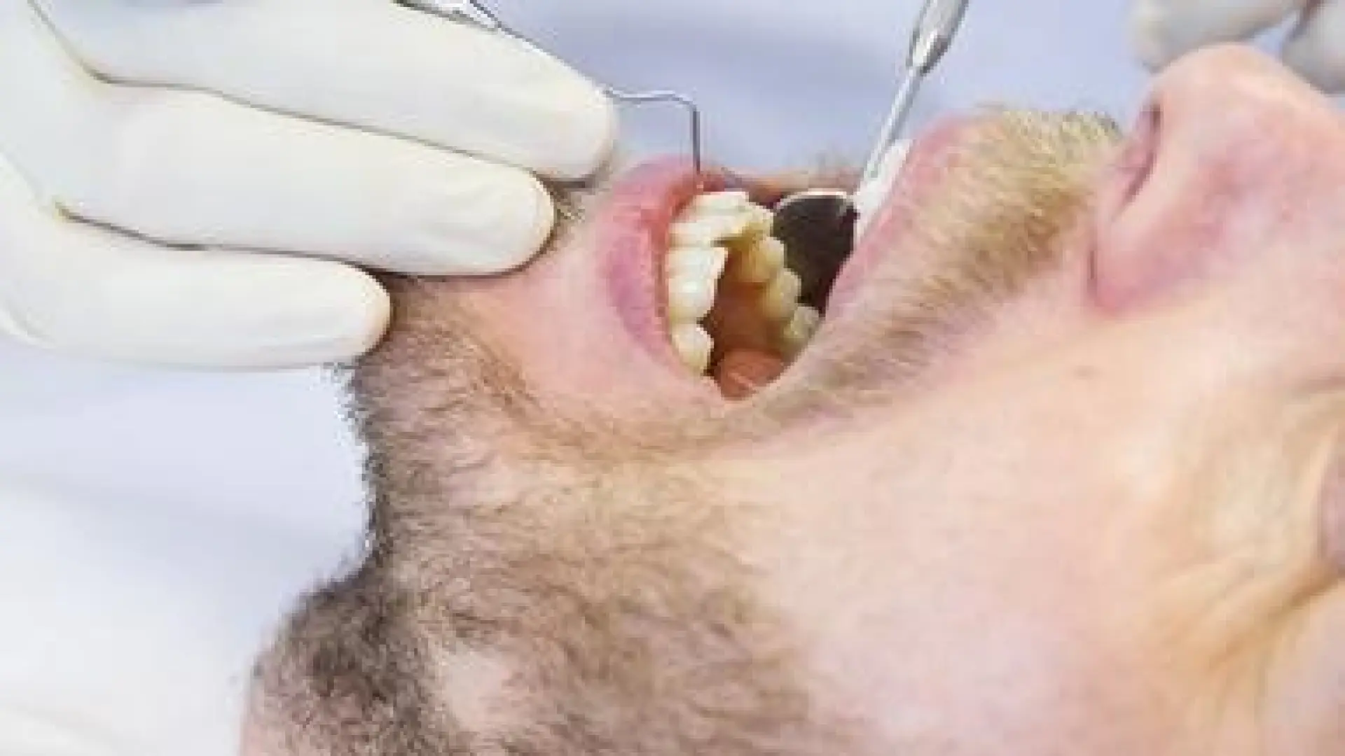 Los trucos de una dentista para tener los dientes blancos cada día sin recurrir a un blanqueamiento