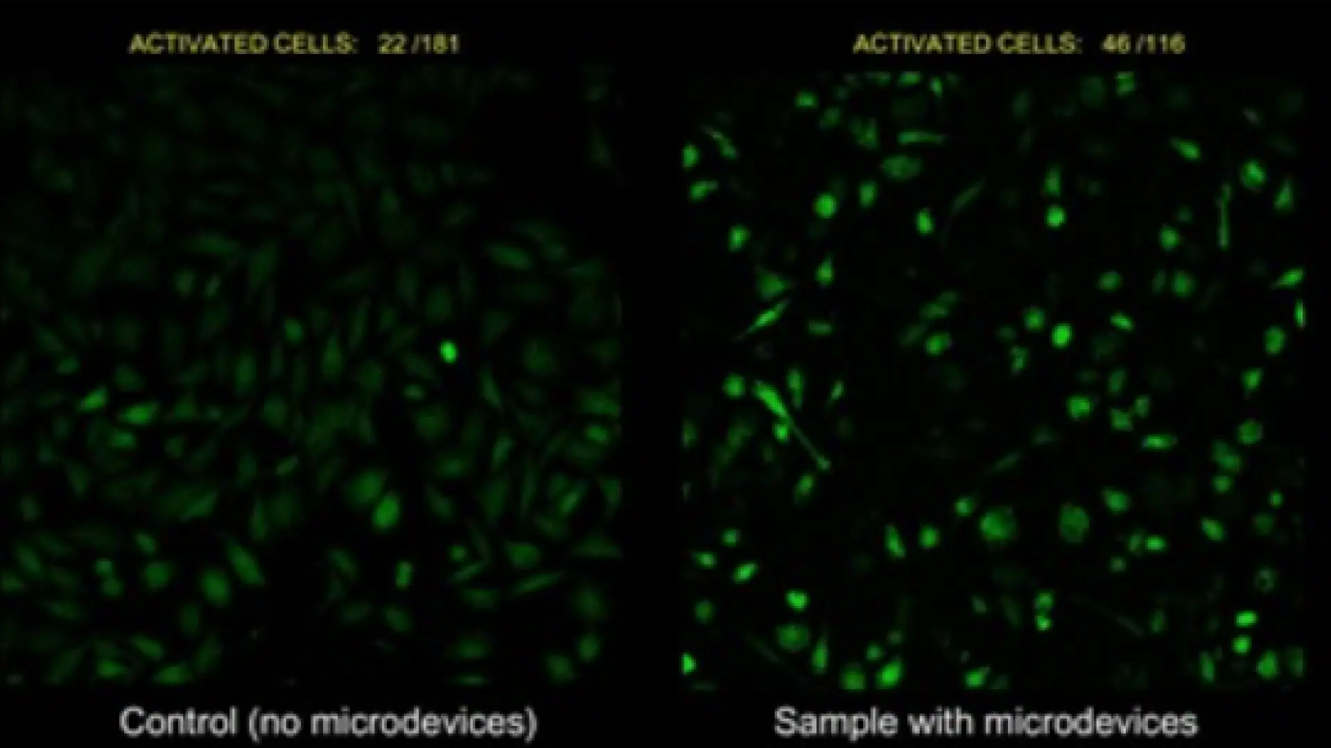 Nuevos microdispositivos consiguen activar células a distancia mediante ultrasonidos: «Permitirían una terapia muy precisa y dirigida»
