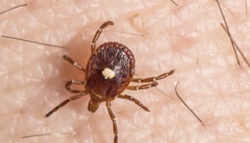 Una picadura de garrapata puede causar alergia a la carne