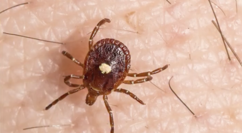 Una picadura de garrapata puede causar alergia a la carne