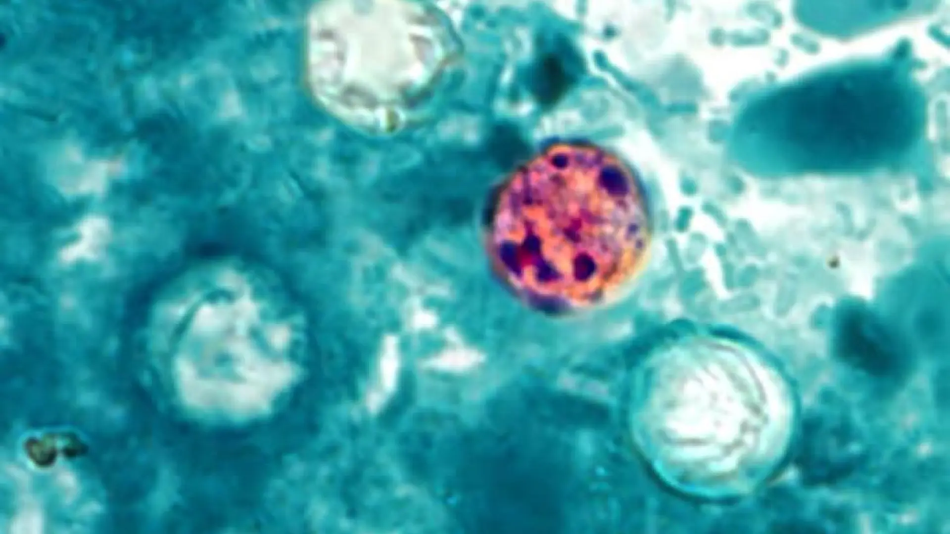 La 'cyclospora' se dispara en Estados Unidos: qué es esta enfermedad parasitaria que provoca diarrea 'explosiva'