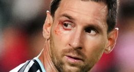 Qué le pasó a Messi en el ojo: el 10 recibió atención en medio de Argentina vs Suiza