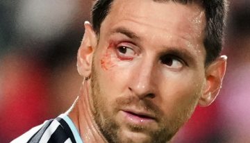 Qué le pasó a Messi en el ojo: el 10 recibió atención en medio de Argentina vs Suiza