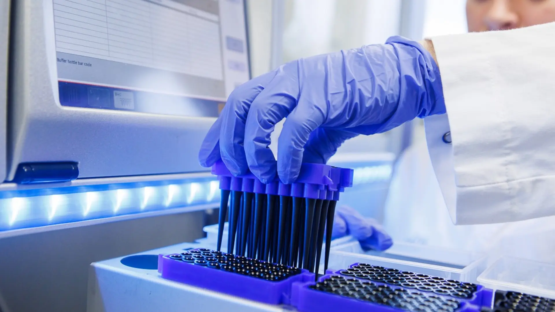 La biopsia líquida podría predecir qué pacientes responderán al tratamiento del cáncer de pulmón
