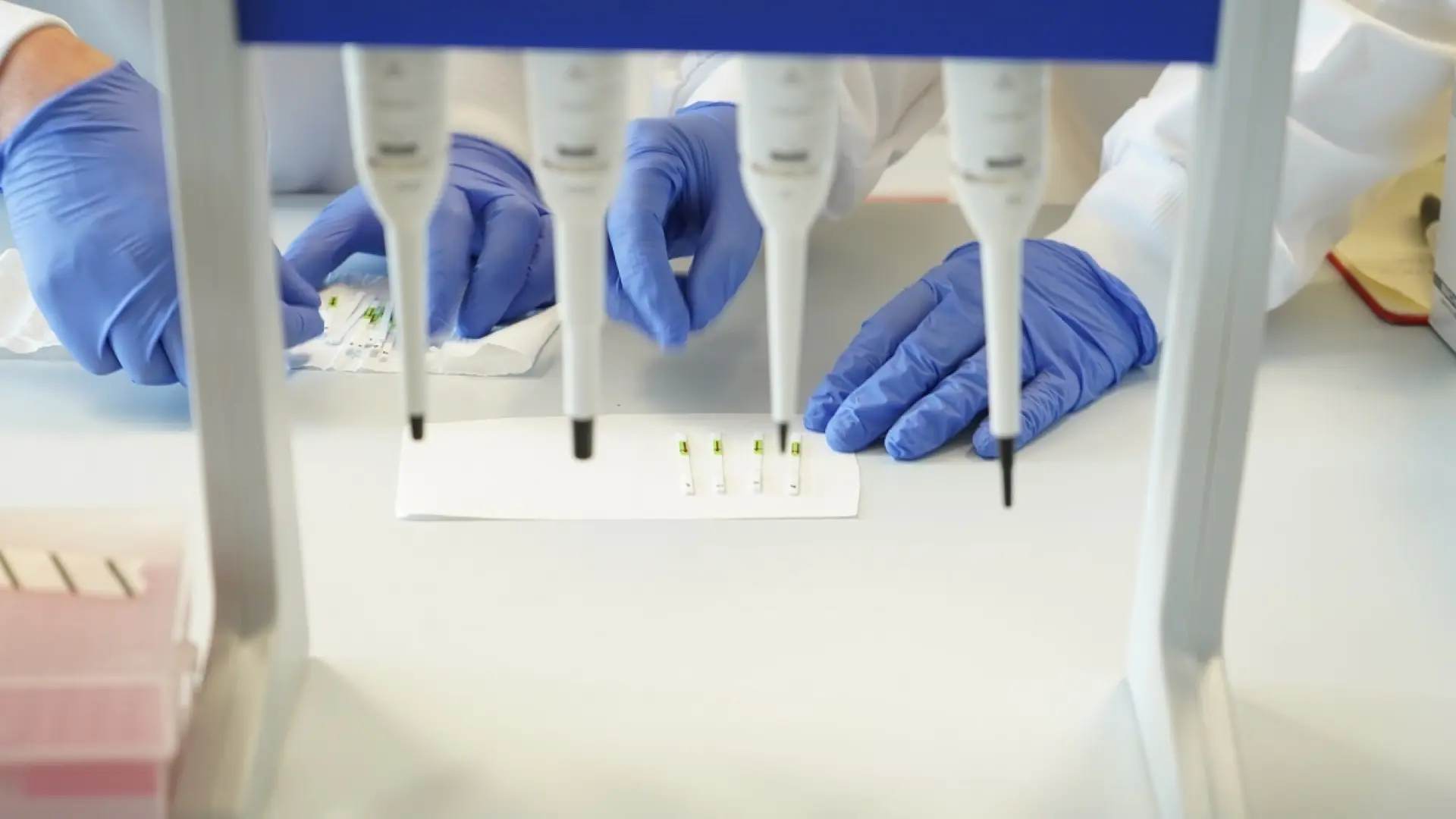 Diseñan unas 'tijeras moleculares' que frenan el VIH en células de laboratorio
