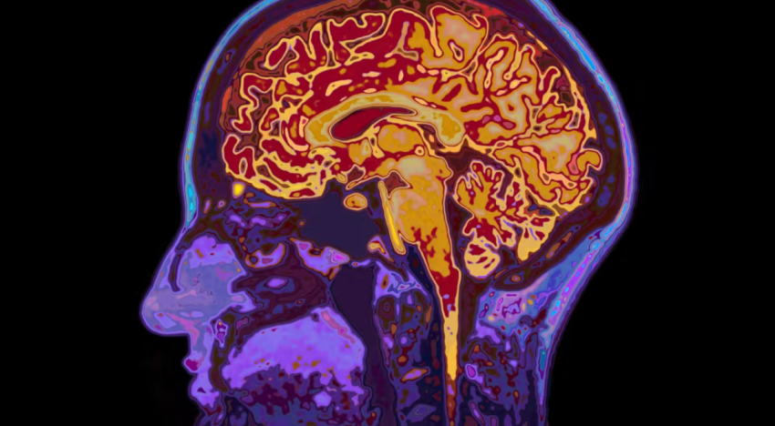 ¿Neuralink ya puede leer la mente? Así funciona el implante que convierte pensamientos en palabras
