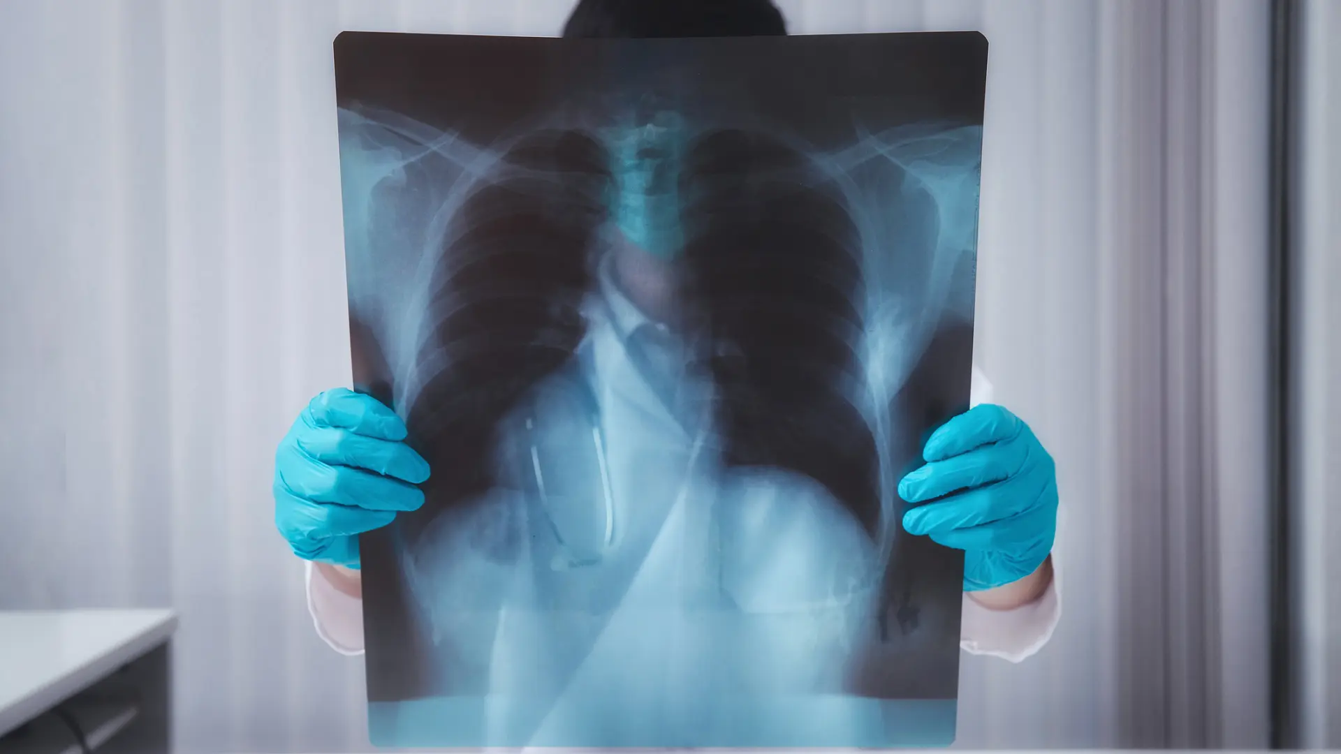 Avance en el cáncer de pulmón: hallan una señal clave para detectarlo a tiempo y saber si el tratamiento funcionará