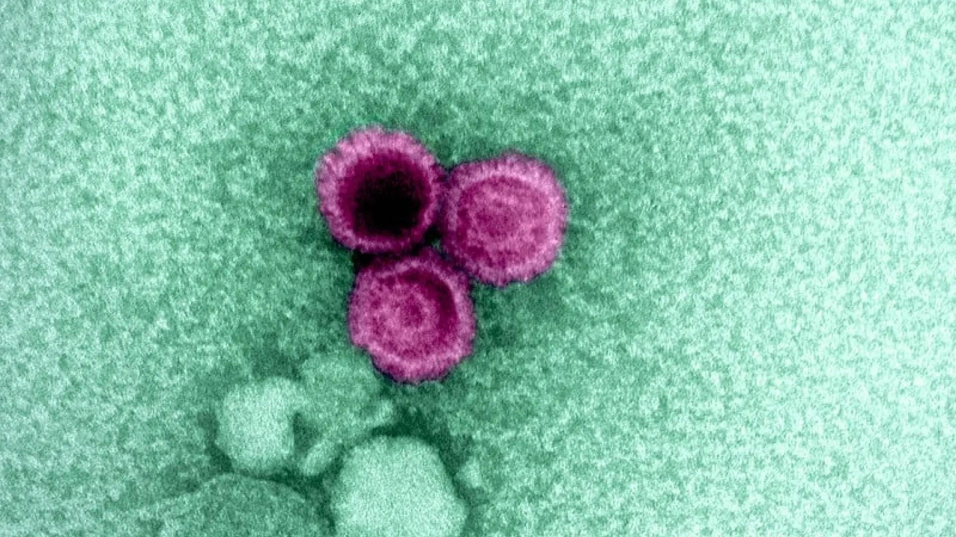Crean un nuevo anticuerpo capaz de bloquear un virus que infecta al 95% de las personas