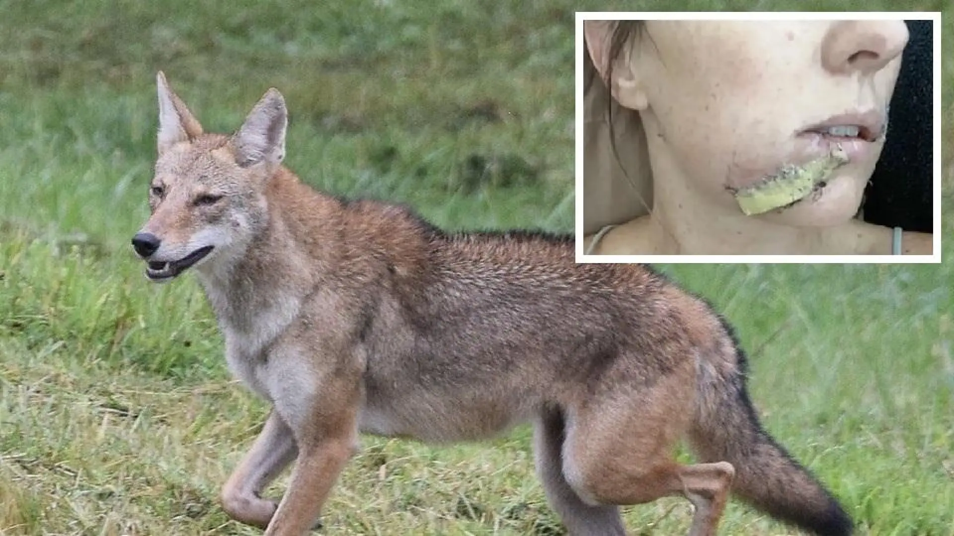 Una madre salva a su hija del ataque de un coyote a golpes de chancla y acaba herida en el rostro: «No lo dudé ni un instante»