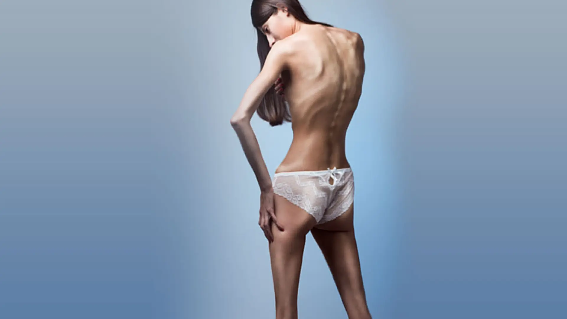 Descubren un gen relacionado con la anorexia que actúa en la grasa y no en el cerebro