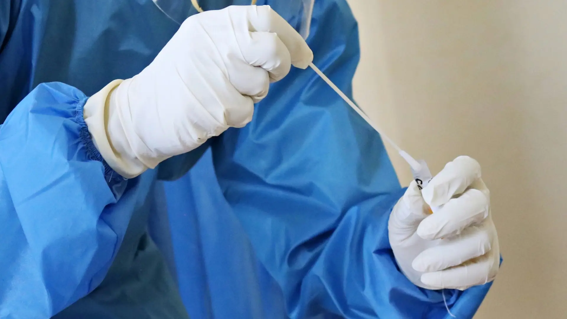 Descubren el peligroso «punto débil» del hantavirus andino y cómo consigue entrar en las células humanas