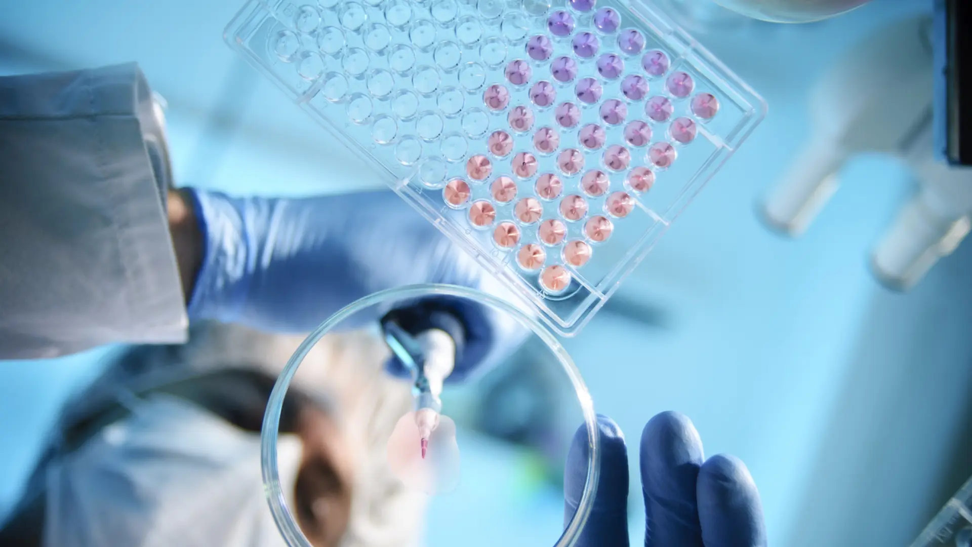 Un estudio revela cómo una bacteria intestinal es capaz de burlar una de las primeras defensas del organismo