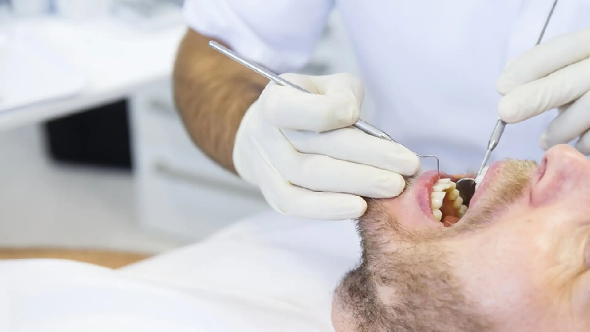 Qué es la piorrea (periodontitis): causas, síntomas asociados y tratamiento